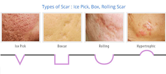 Under Eye Bags, Acne Scars & Neck Creasing: When Over-the-Counter