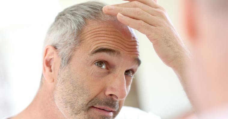 How to Choose a Hair Loss Product, Even If You Don’t Know What to Do How to Choose a Hair Loss Product, Even If You Don’t Know What to Do