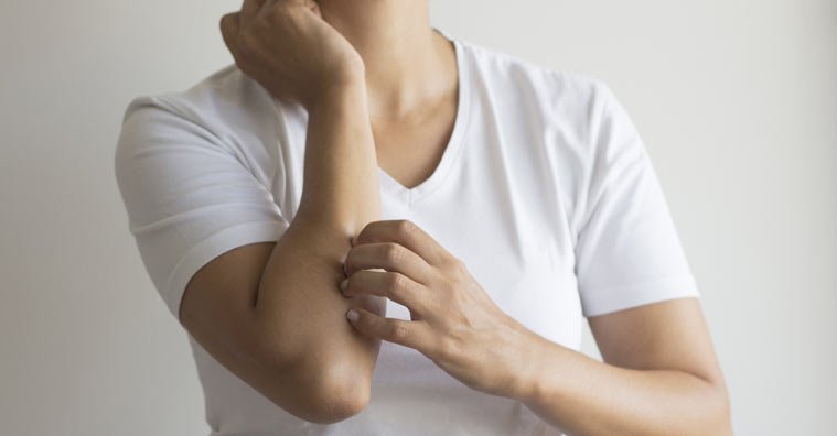 Expert Buying Guide: Best Clinical and OTC Remedies for People with Eczema Expert Buying Guide: Best Clinical and OTC Remedies for People with Eczema