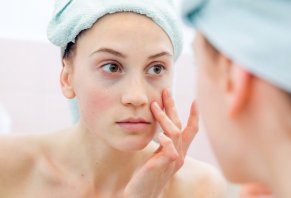 At-Home Treatments for Dark Circles Under Your Eye